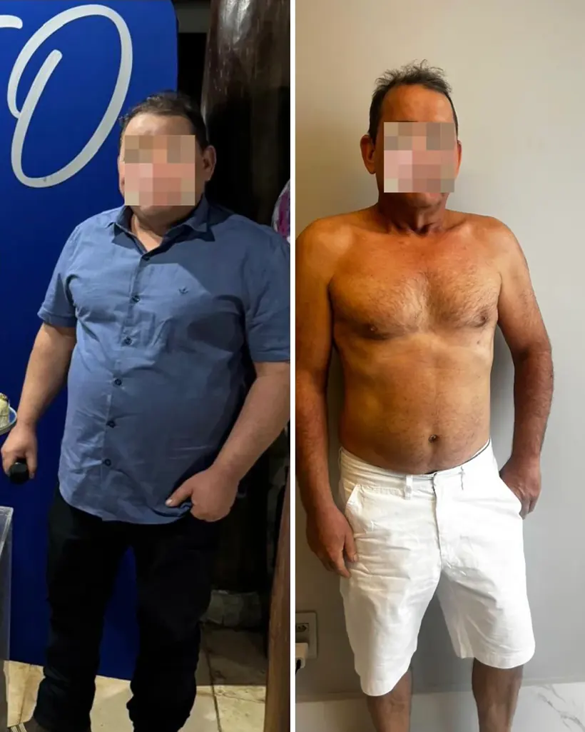 Antes e depois — caso 2