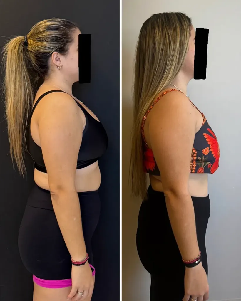 Antes e depois — caso 3