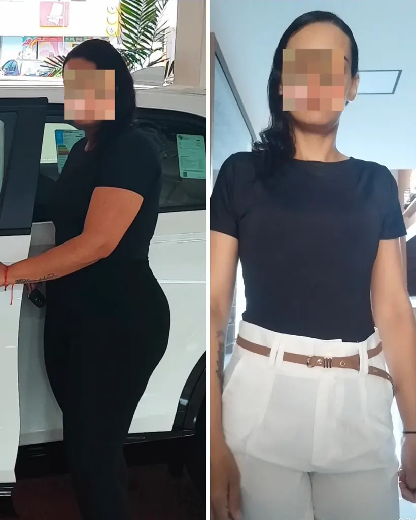 Antes e depois — caso 4
