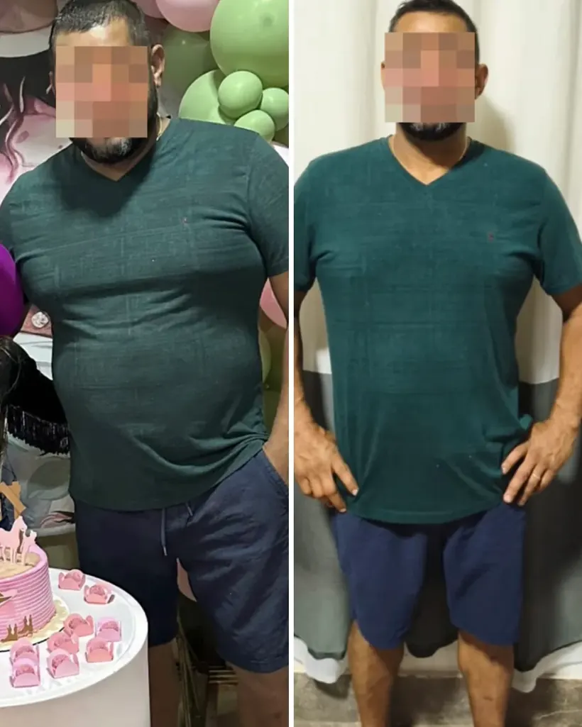 Antes e depois — caso 5
