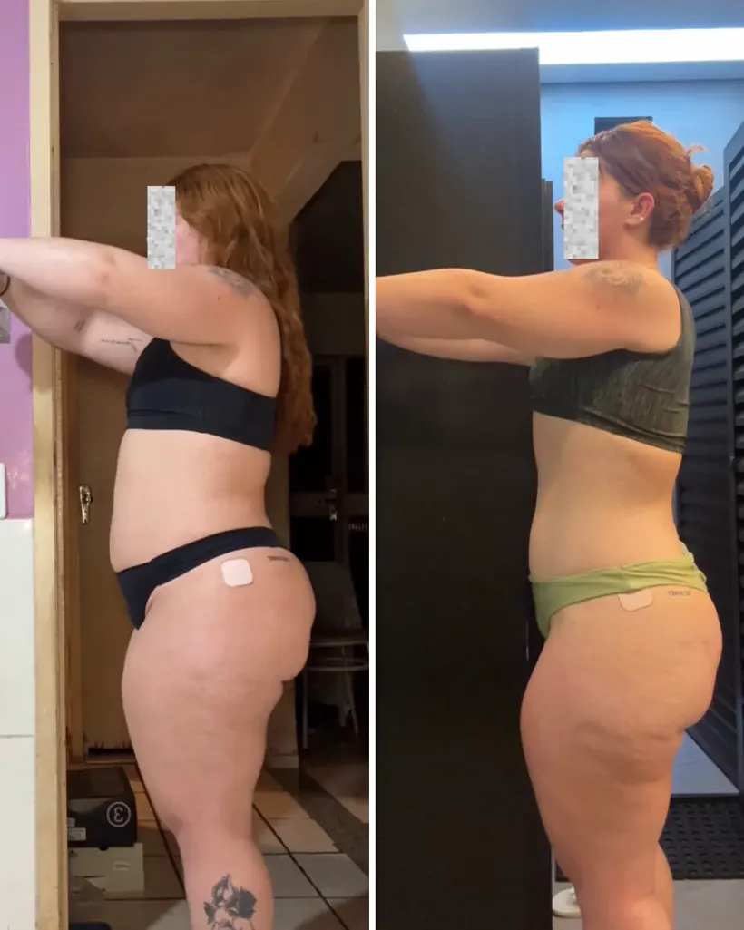 Antes e depois — caso 6