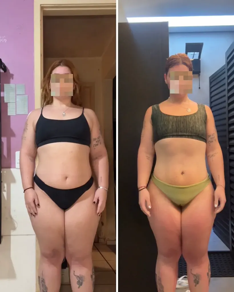 Antes e depois — caso 7