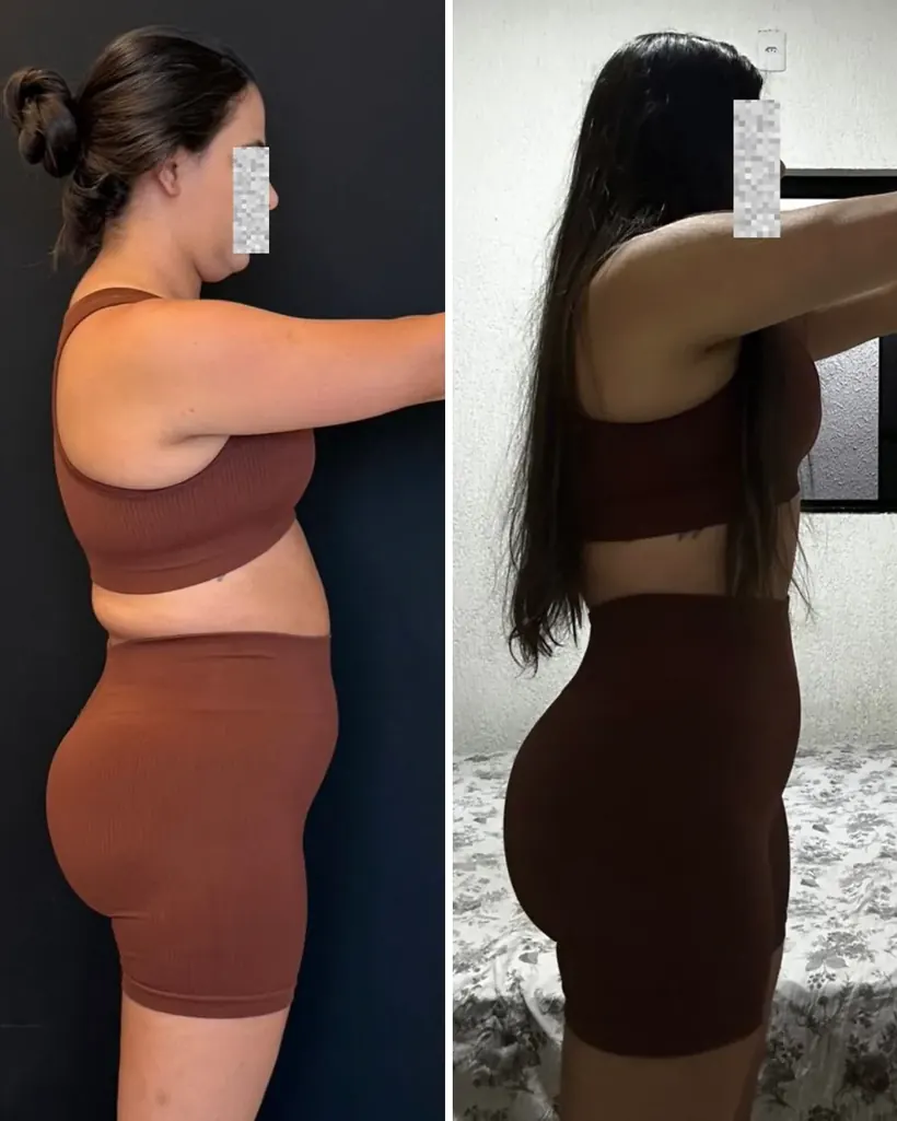 Antes e depois — caso 8